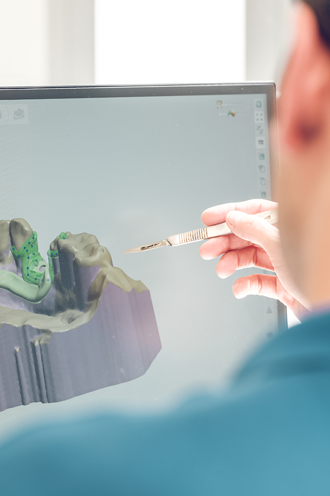 Dentist using digital technology to enhance dental implants by examining 3D model on computer • KOREA NEW N DENTAL CLINIC