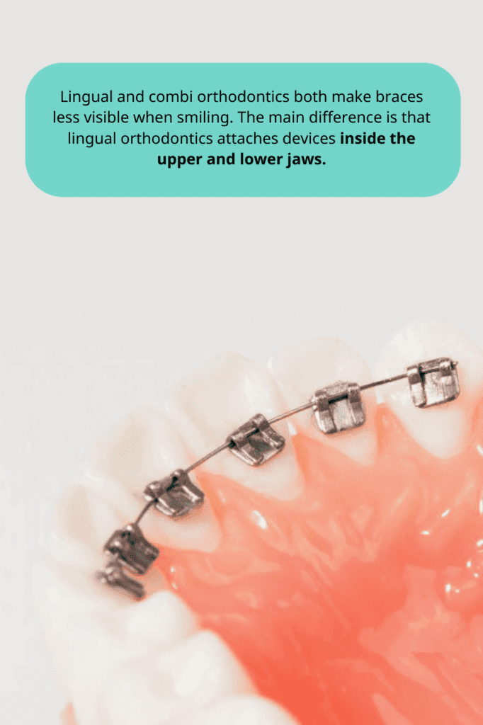 Close-up of braces on teeth showcasing the difference between lingual and combi orthodontics with devices attached inside the upper and lower jaws • KOREA NEW N DENTAL CLINIC