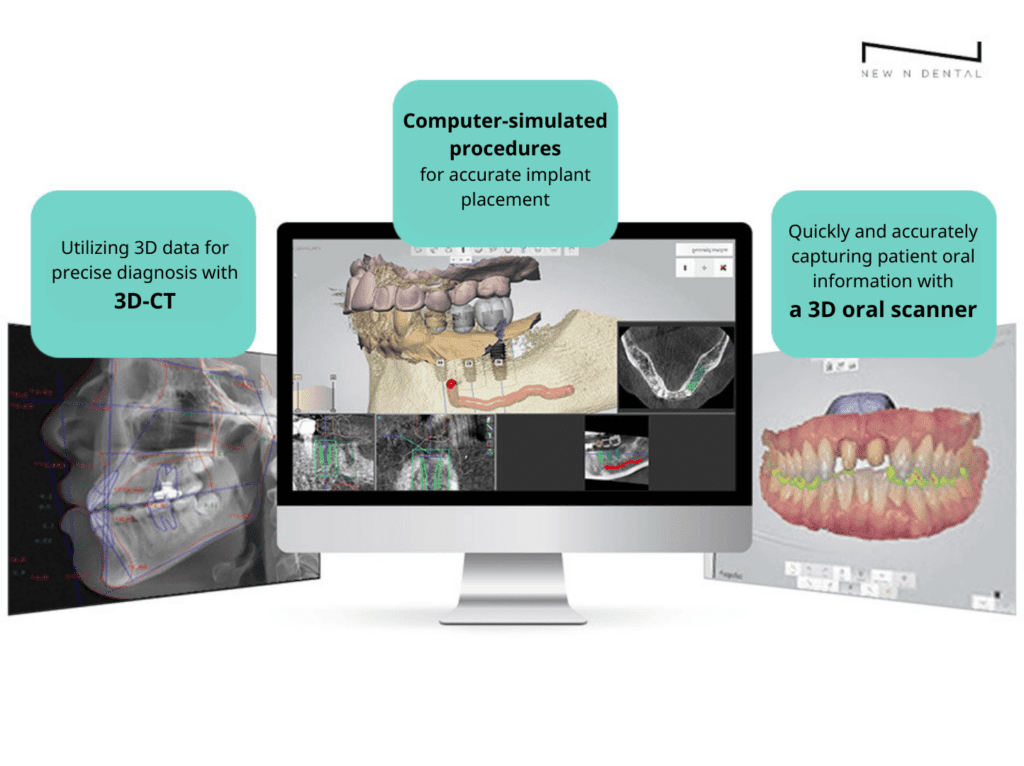 A computer displaying 3D CT data for precise dental diagnosis, computer-simulated implant procedures, and 3D oral scanner data capturing detailed patient information. • KOREA NEW N DENTAL CLINIC