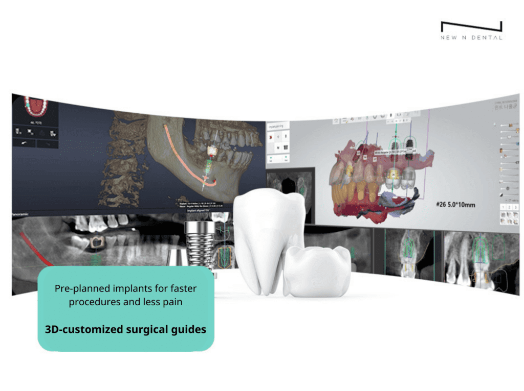 Image showcasing advanced 3D customized surgical guides for pre-planning dental implant procedures to improve accuracy and reduce patient pain, with a digital interface displaying detailed dental implant positioning. • KOREA NEW N DENTAL CLINIC