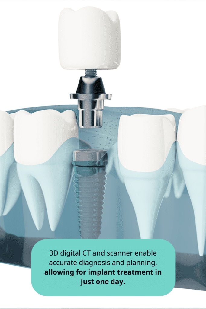 3D digital CT scan for accurate dental implant diagnosis and planning, showing implant placement in a jaw. • KOREA NEW N DENTAL CLINIC