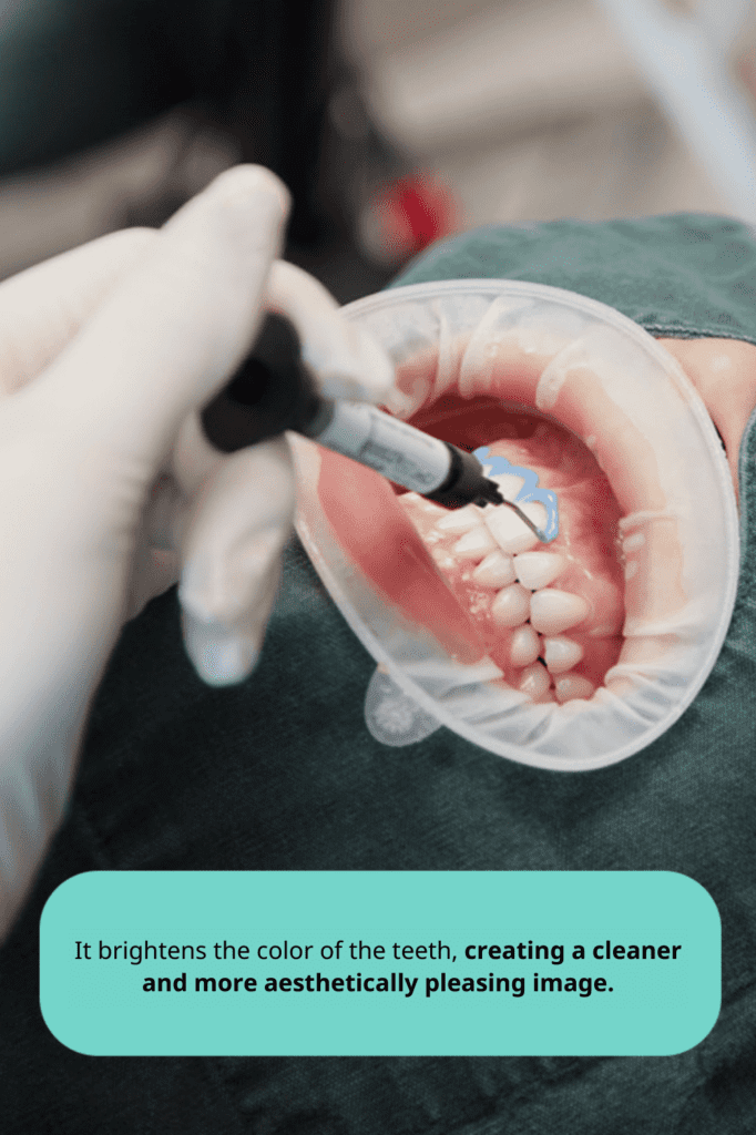 Teeth Whitening Procedure for Enhanced Dental Aesthetics • Dental Clinic for English Speakers in Korea Dentist applying teeth whitening gel to patient for a brighter and more aesthetically pleasing smile • KOREA NEW N DENTAL CLINIC
