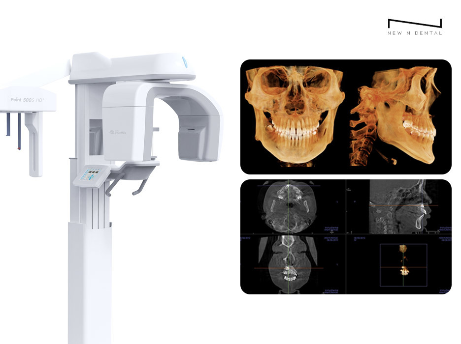 Advanced 3D CBCT machine for dental imaging with detailed scans, demonstrating accurate exams and diagnoses through high-resolution skull images. • KOREA NEW N DENTAL CLINIC