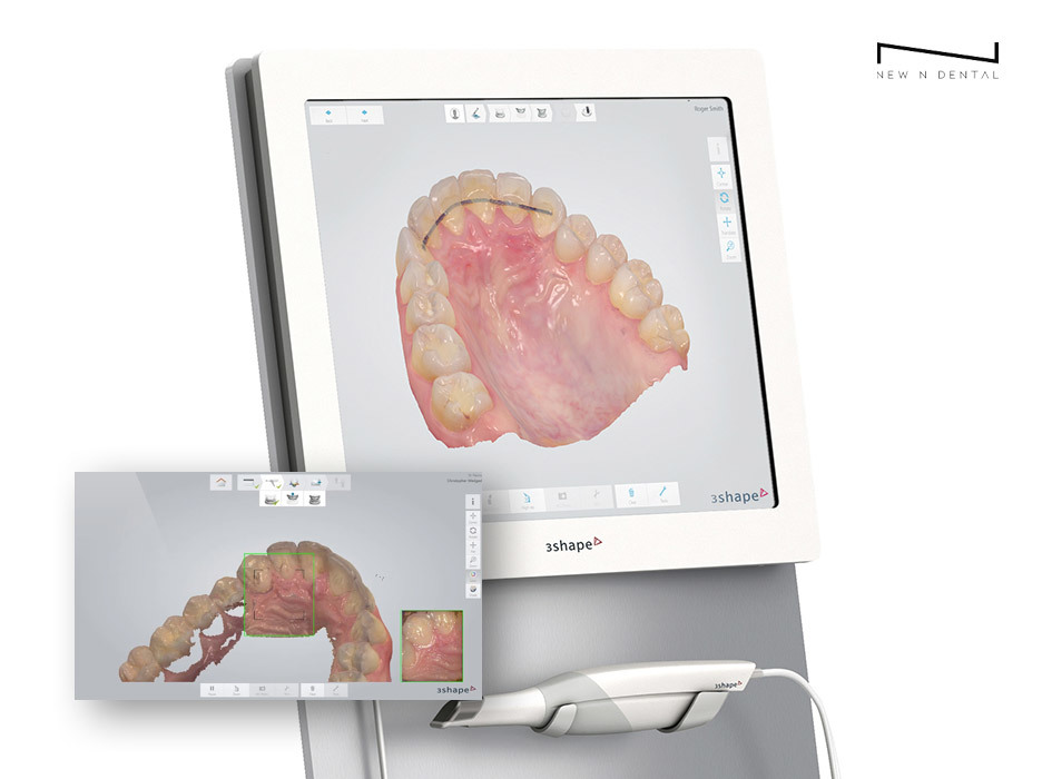 3Shape TRIOS 3D Oral Scanner displaying detailed dental scan on screen • KOREA NEW N DENTAL CLINIC