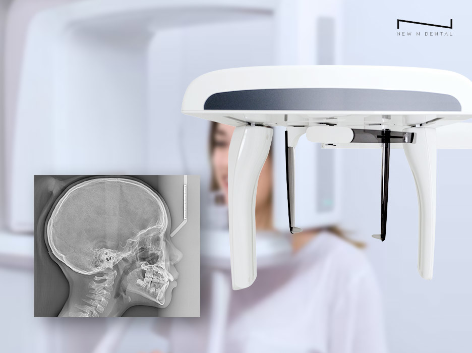 Side view of cephalometric radiography performed in a dental office with X-ray showing skull and dental structure • KOREA NEW N DENTAL CLINIC