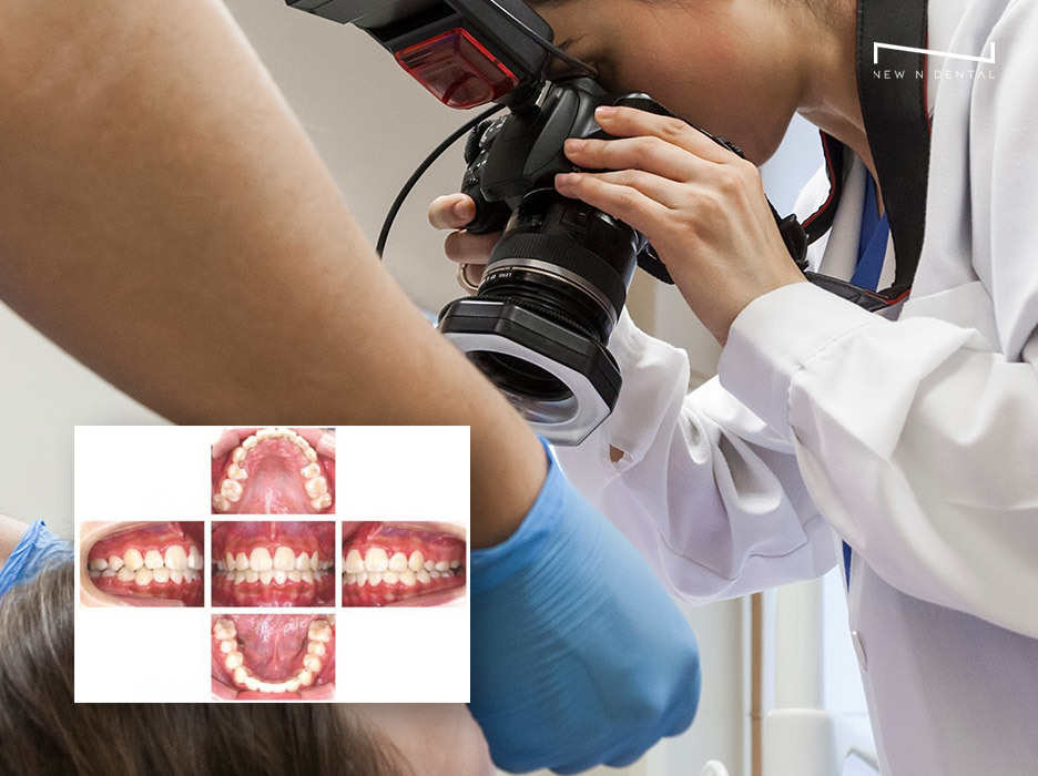 Dental professional using a camera for intraoral and extraoral photography with detailed images of teeth and mouth • KOREA NEW N DENTAL CLINIC