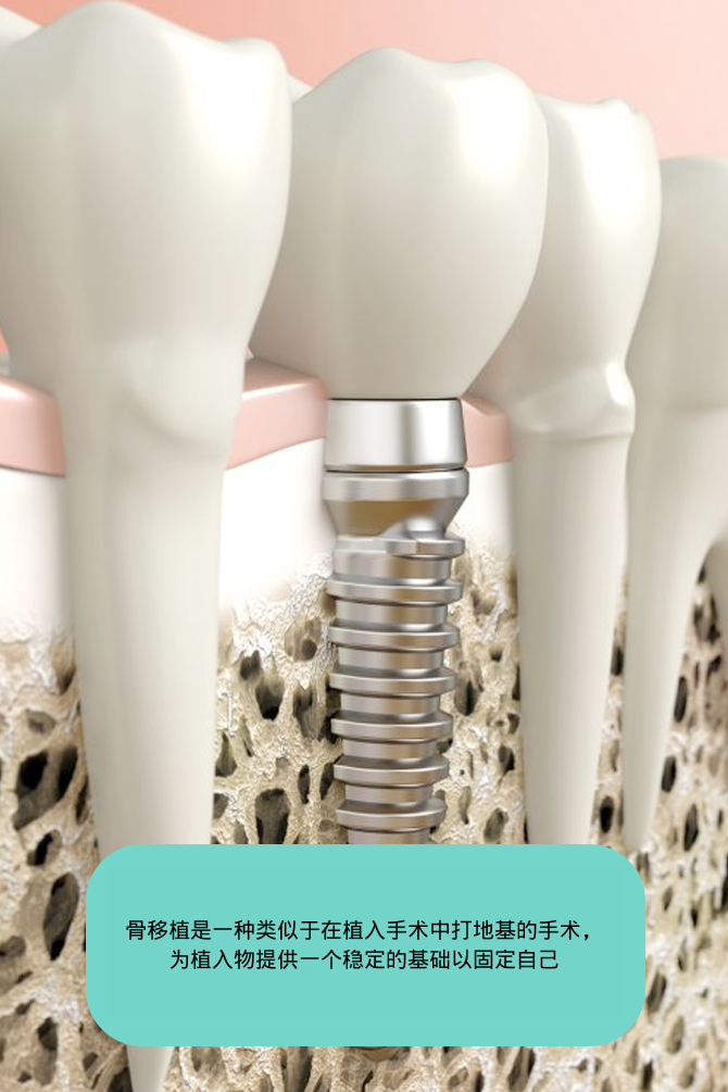 re_sub02_05_sec01_img01 cn • Dental Clinic for English Speakers in Korea • KOREA NEW N DENTAL CLINIC