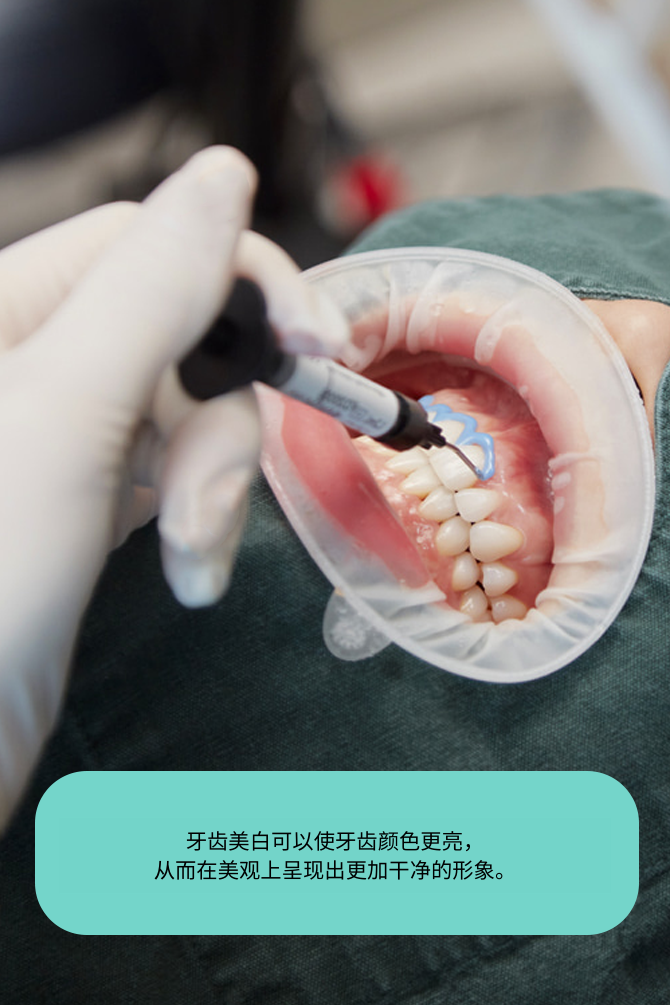 re_sub04_02_sec01_img01_2404 cn • Dental Clinic for English Speakers in Korea • KOREA NEW N DENTAL CLINIC