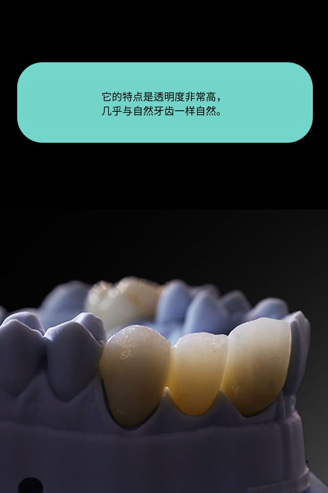 re_sub04_03_sec01_img01_2404 cn • Dental Clinic for English Speakers in Korea • KOREA NEW N DENTAL CLINIC