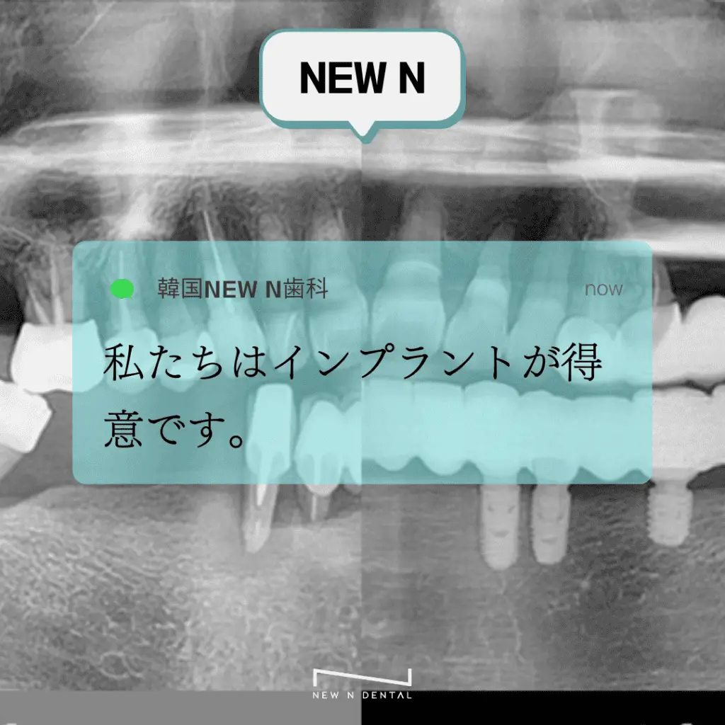 歯のX線画像と「インプラントが得意です」とのテキストメッセージ