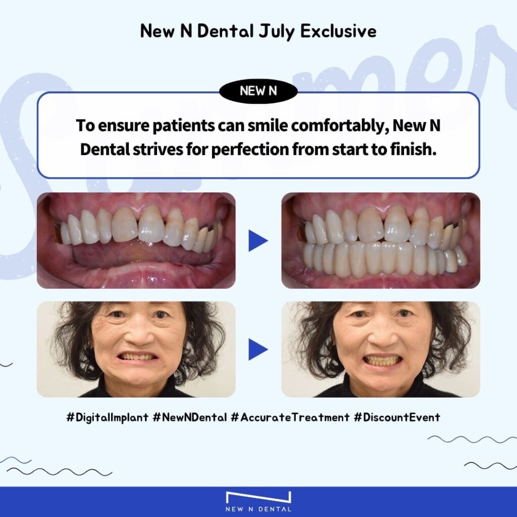 Advertisement showing before and after photos of a patient who received digital implants at New N Dental. Highlights the transformation achieved through implants. • KOREA NEW N DENTAL CLINIC