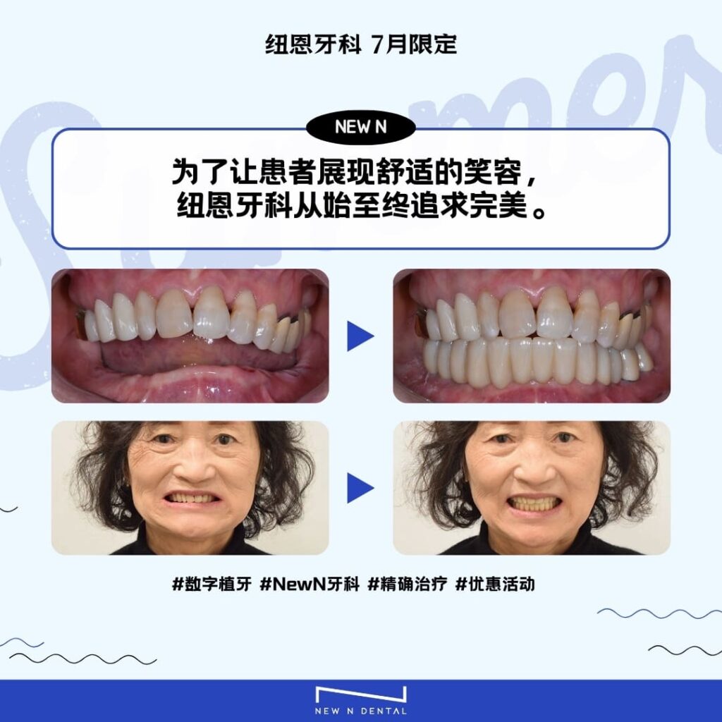 展示在New N牙科接受数字植牙的患者前后照片的广告。强调通过植牙实现的转变。