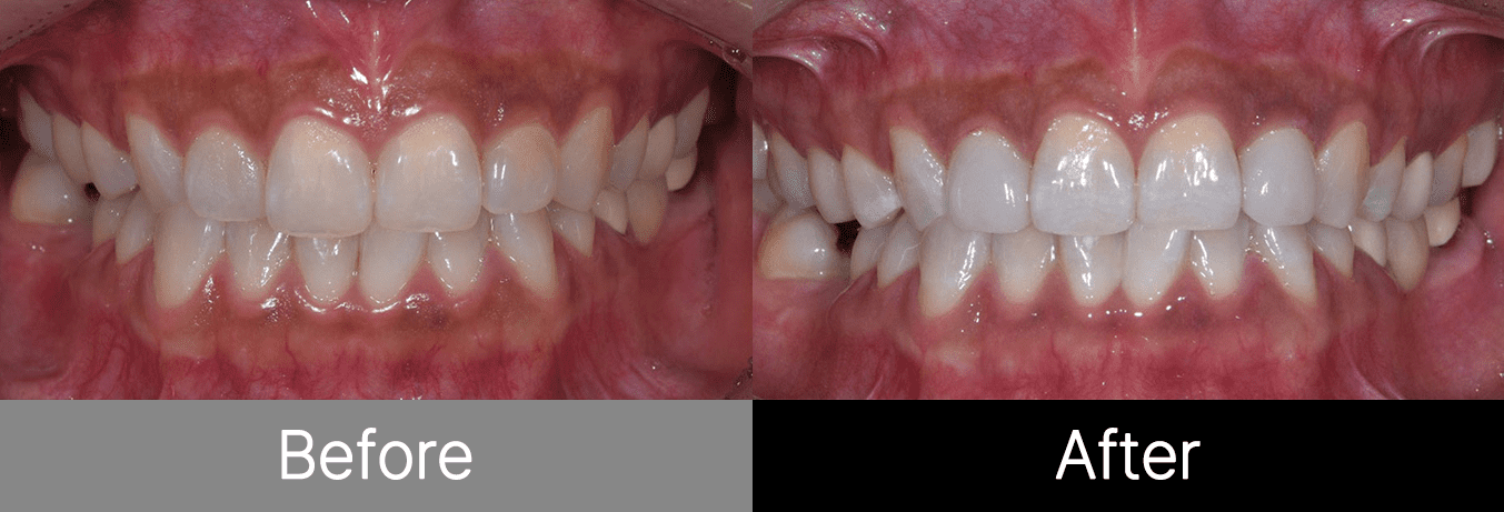 #image_title #separator_sa KOREA NEW N DENTAL CLINIC