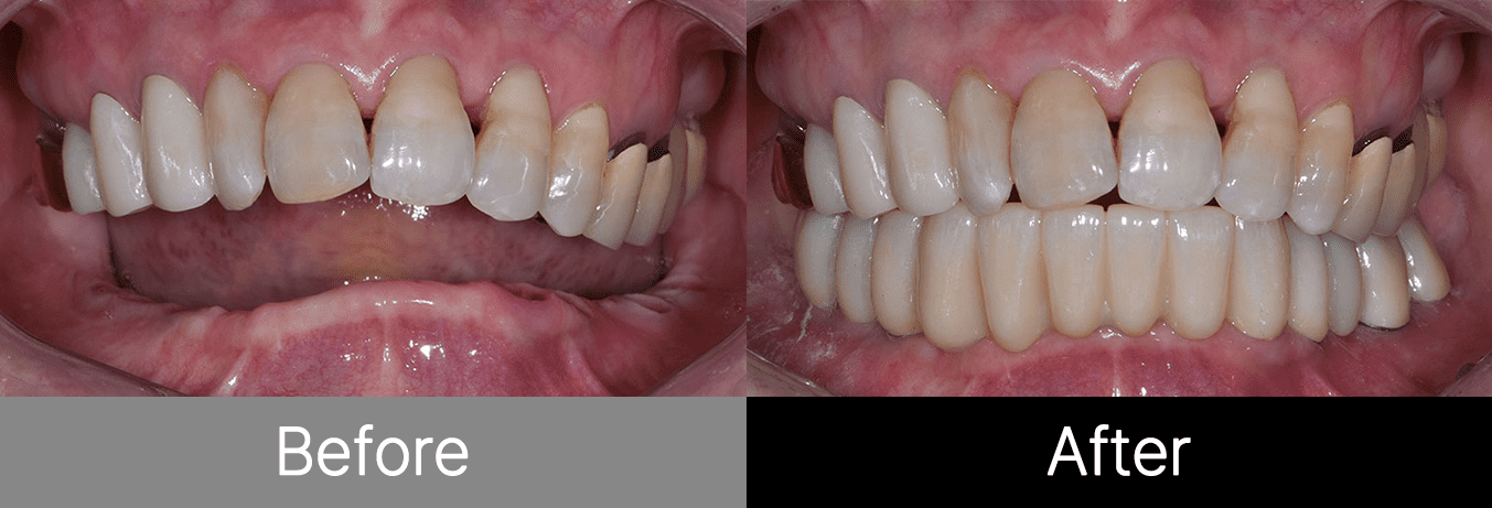 #image_title #separator_sa KOREA NEW N DENTAL CLINIC