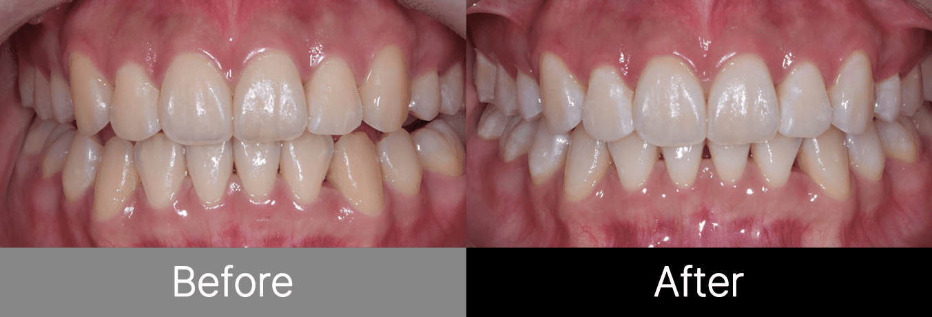 #image_title #separator_sa KOREA NEW N DENTAL CLINIC