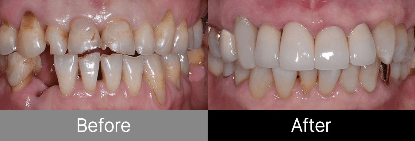 #image_title #separator_sa KOREA NEW N DENTAL CLINIC