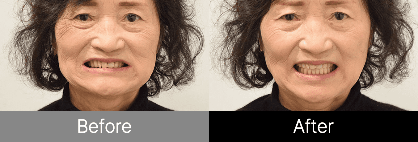 #image_title #separator_sa KOREA NEW N DENTAL CLINIC