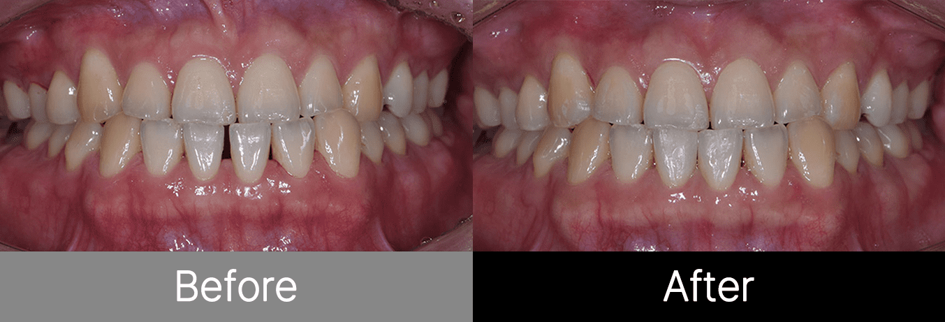 #image_title #separator_sa KOREA NEW N DENTAL CLINIC