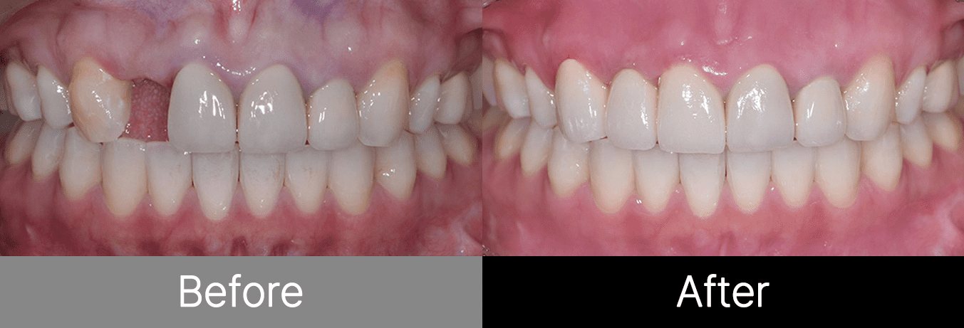 #image_title #separator_sa KOREA NEW N DENTAL CLINIC