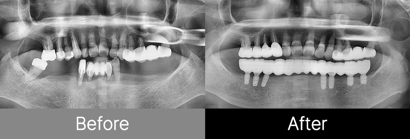 #image_title #separator_sa KOREA NEW N DENTAL CLINIC