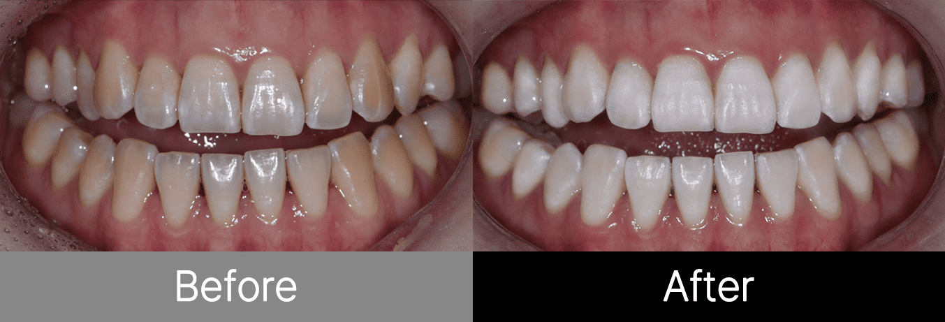 #image_title #separator_sa KOREA NEW N DENTAL CLINIC