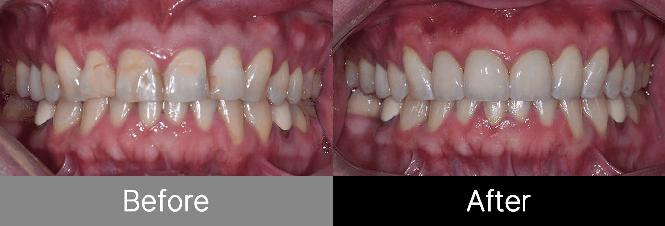 #image_title #separator_sa KOREA NEW N DENTAL CLINIC