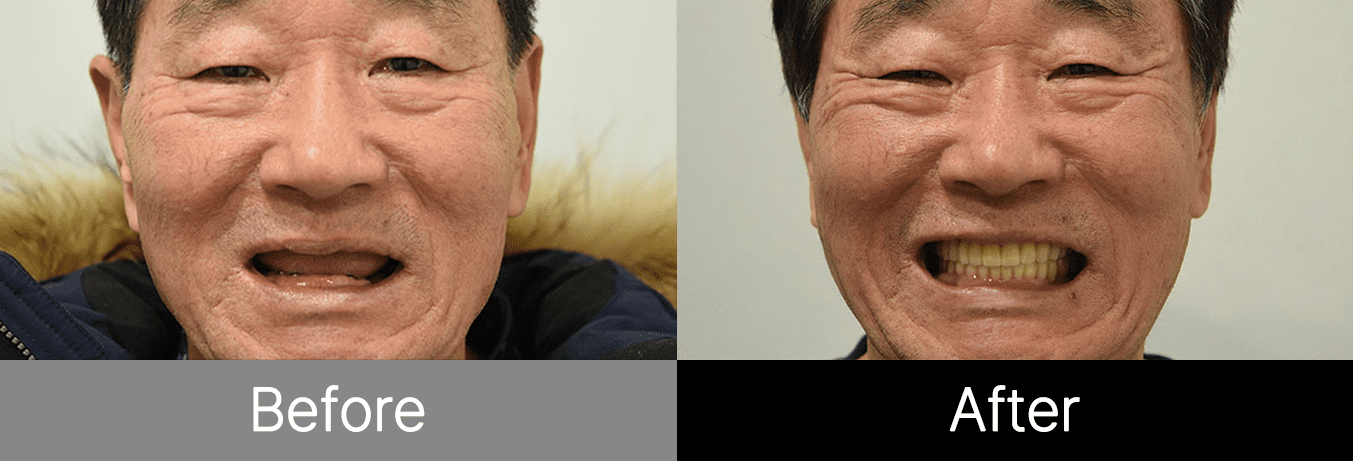 #image_title #separator_sa KOREA NEW N DENTAL CLINIC