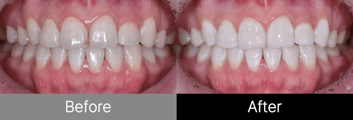 #image_title #separator_sa KOREA NEW N DENTAL CLINIC