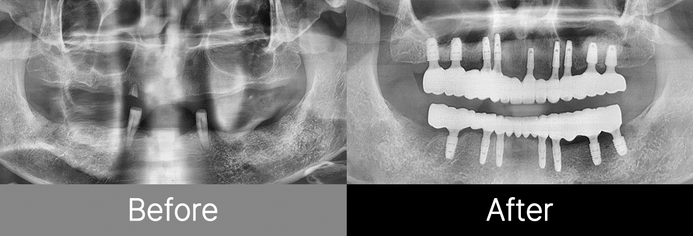 #image_title #separator_sa KOREA NEW N DENTAL CLINIC