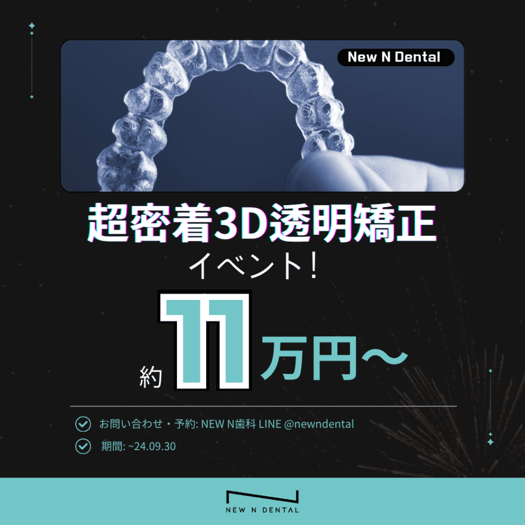 「New N Dental 超密着3D透明矯正イベント！約11万円～」と書かれた広告画像です。画像の上部には3Dレンダリングされた透明矯正装置が表示され、下部には「約11万円～」という価格情報が強調されています。 • KOREA NEW N DENTAL CLINIC