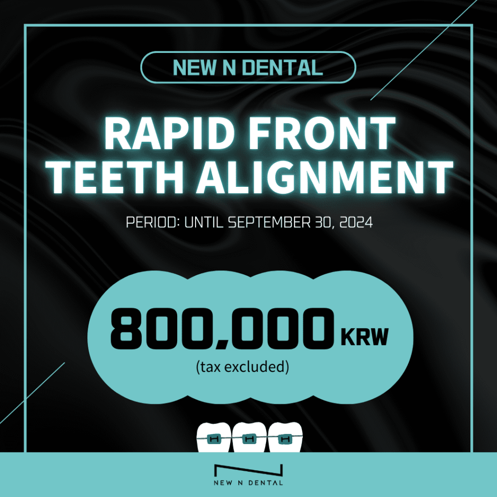 NEW IN DENTAL RAPID FRONT TEETH ALIGNMENT (Period until September 30, 2023) 800,000 KRW Be evaluated • KOREA NEW N DENTAL CLINIC