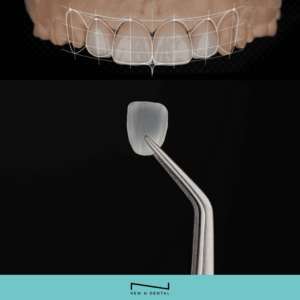  • KOREA NEW N DENTAL CLINIC