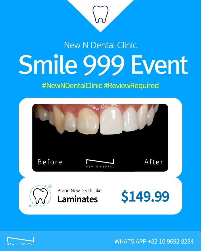 Before and after result of dental laminates at New N Dental Clinic Korea. Affordable $149.99 treatment. Korea dental clinic for teeth whitening and laminates.
