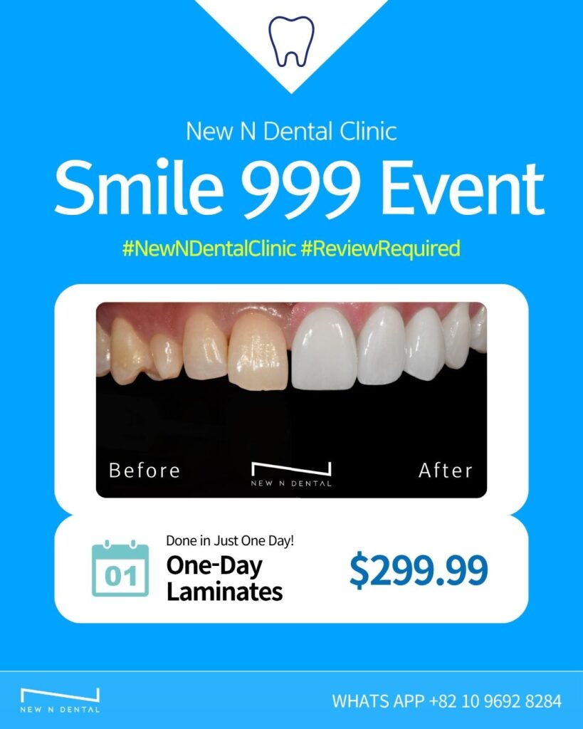 Korea Dental Clinic teeth whitening laminates before and after results - New N Dental Clinic Smile 999 Event offering one-day dental laminates for $299.99 in Seoul, Korea. Professional Korean dental teeth whitening treatment showing dramatic smile transformation from discolored teeth to bright white veneers completed in just one day.