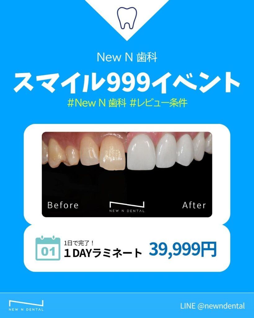 韓国New N歯科スマイル999イベント - 韓国歯科ラミネート治療のビフォーアフター効果写真。韓国歯科医院でのラミネート治療19,999円、新品のような美しい歯に変身。日本人向け韓国歯科ホワイトニング・ラミネート治療の特別価格キャンペーン、韓国専門歯科クリニックでの高品質ラミネート技術。 • KOREA NEW N DENTAL CLINIC