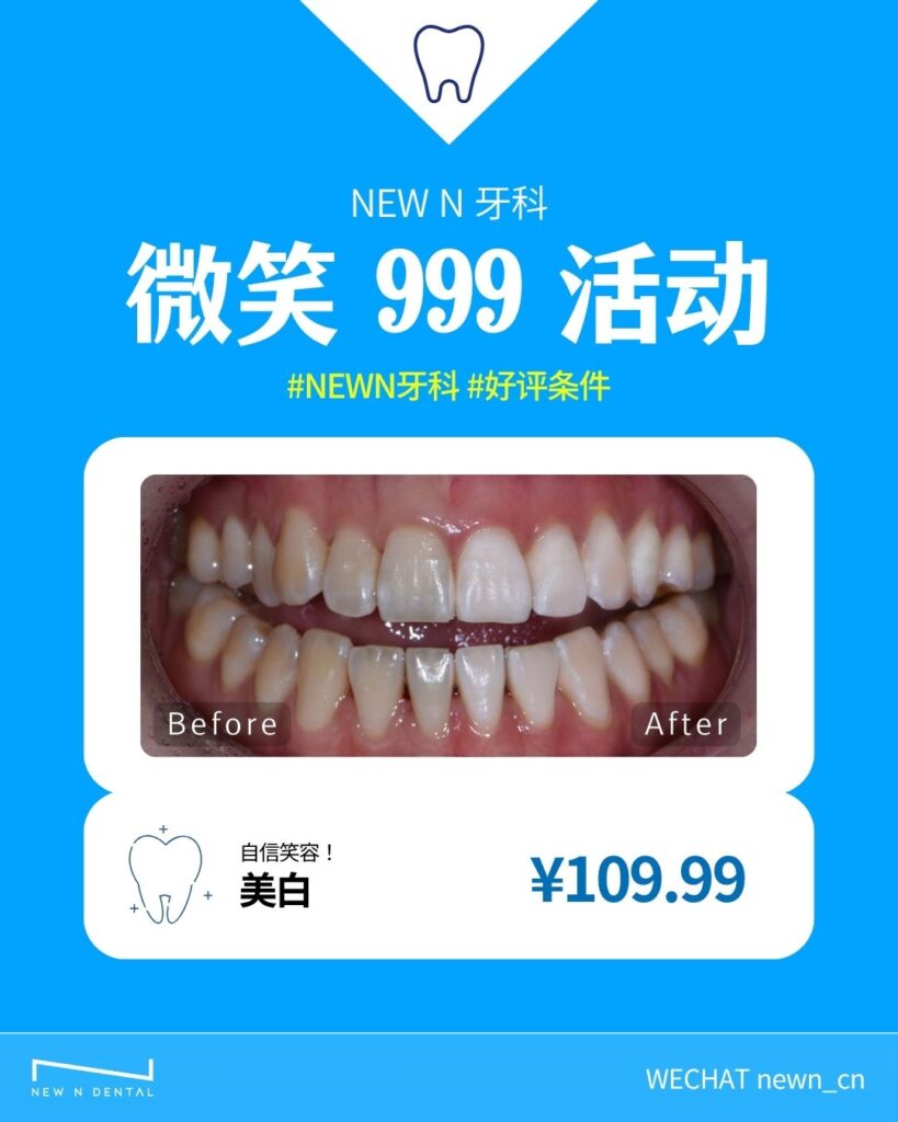 韩国NEW N牙科微笑999活动 - 韩国牙科美白治疗前后对比效果图，显示dramatic牙齿美白效果。韩国专业牙科诊所提供牙齿美白和贴面服务，美白治疗仅¥109.99。面向中国患者的韩国牙科美白laminate治疗优惠活动，展现专业teeth whitening技术效果。