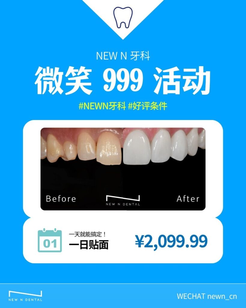 韩国NEW N牙科微笑999活动 - 韩国牙科一日贴面治疗前后对比效果图，展示专业韩国牙齿美白贴面技术。韩国牙科诊所一日贴面治疗¥2,099.99，一天就能搞定完美笑容。为中国患者提供高品质韩国牙科美白和快速贴面服务，韩国专业牙医一日贴面修复技术。