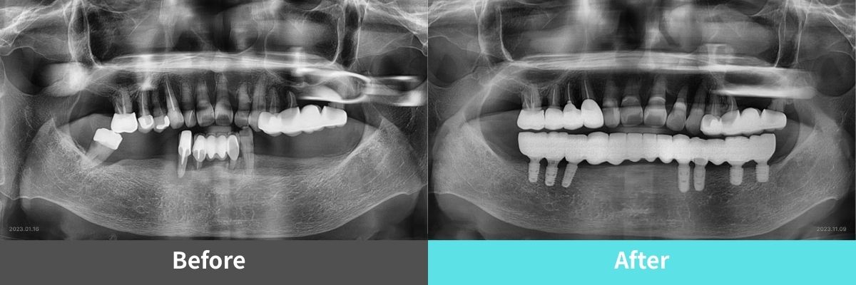 #image_title #separator_sa KOREA NEW N DENTAL CLINIC