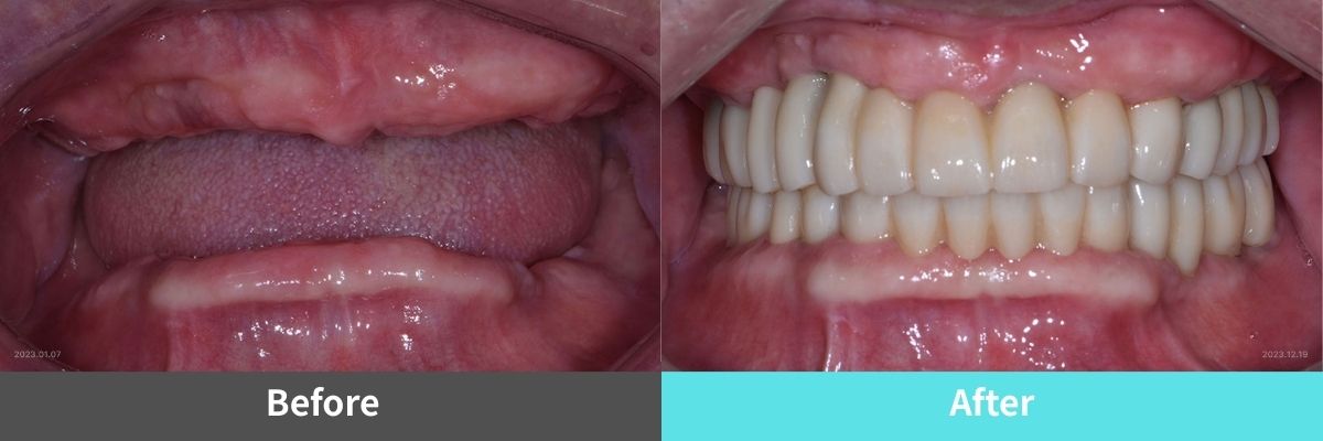 #image_title #separator_sa KOREA NEW N DENTAL CLINIC