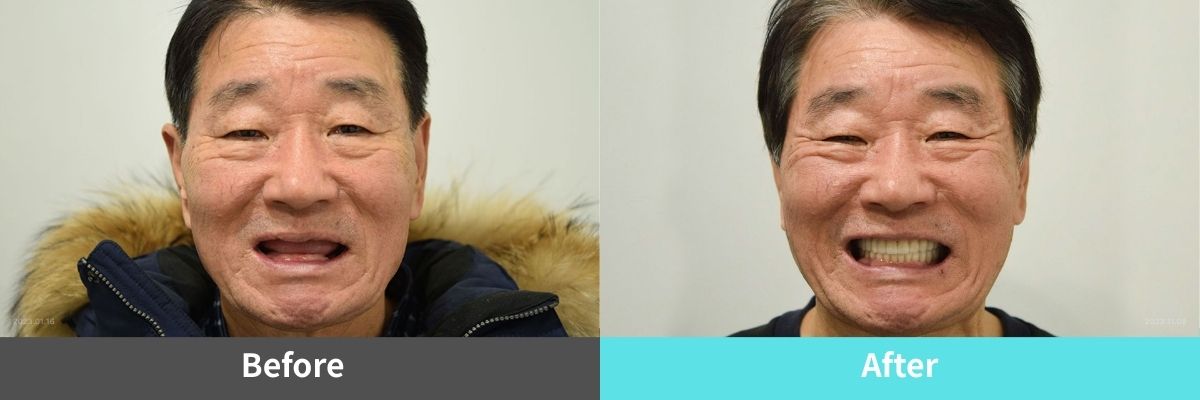 #image_title #separator_sa KOREA NEW N DENTAL CLINIC