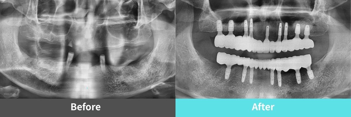 #image_title #separator_sa KOREA NEW N DENTAL CLINIC