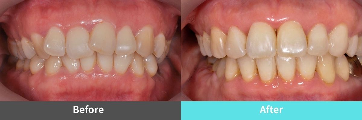 #image_title #separator_sa KOREA NEW N DENTAL CLINIC