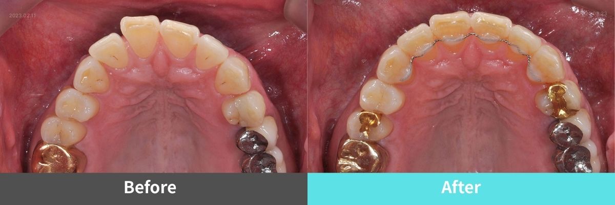 #image_title #separator_sa KOREA NEW N DENTAL CLINIC