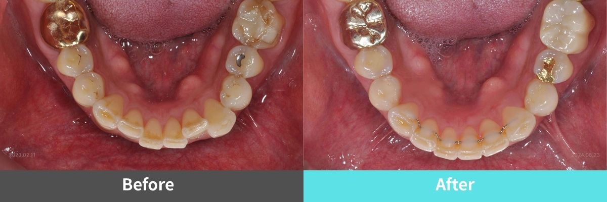 #image_title #separator_sa KOREA NEW N DENTAL CLINIC