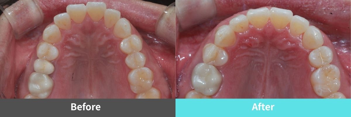 #image_title #separator_sa KOREA NEW N DENTAL CLINIC