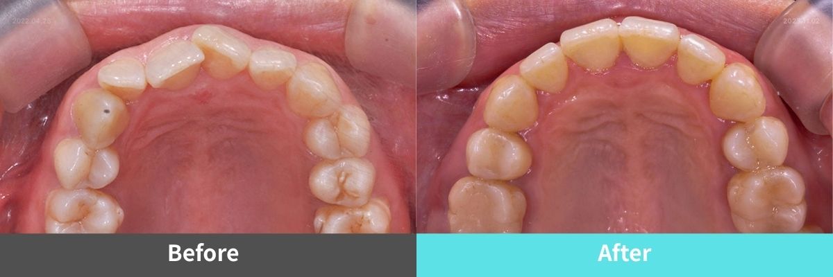 #image_title #separator_sa KOREA NEW N DENTAL CLINIC