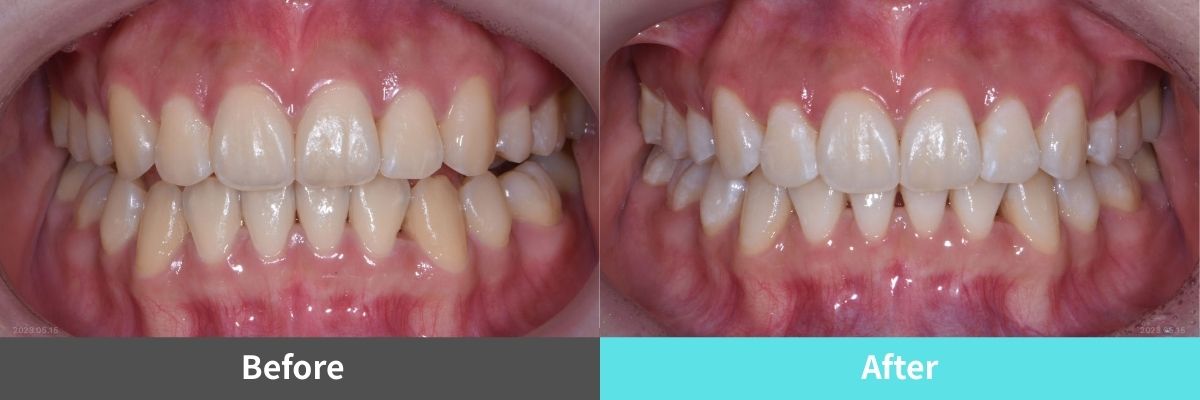 #image_title #separator_sa KOREA NEW N DENTAL CLINIC