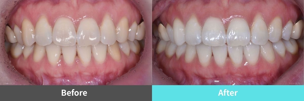 #image_title #separator_sa KOREA NEW N DENTAL CLINIC