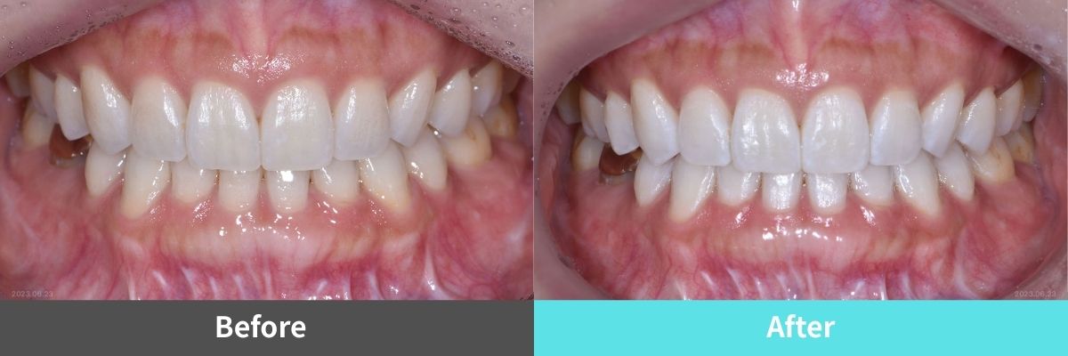 #image_title #separator_sa KOREA NEW N DENTAL CLINIC