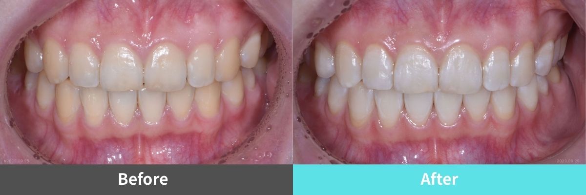 #image_title #separator_sa KOREA NEW N DENTAL CLINIC